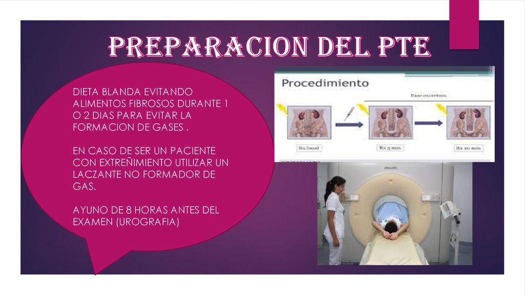 Ligera urografias dieta para